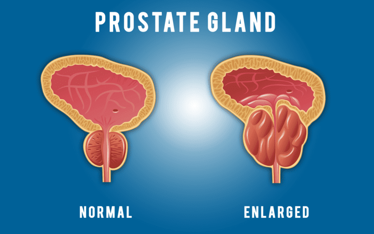 10 Natural Ways to Promote Prostate Wellness for Men's Health